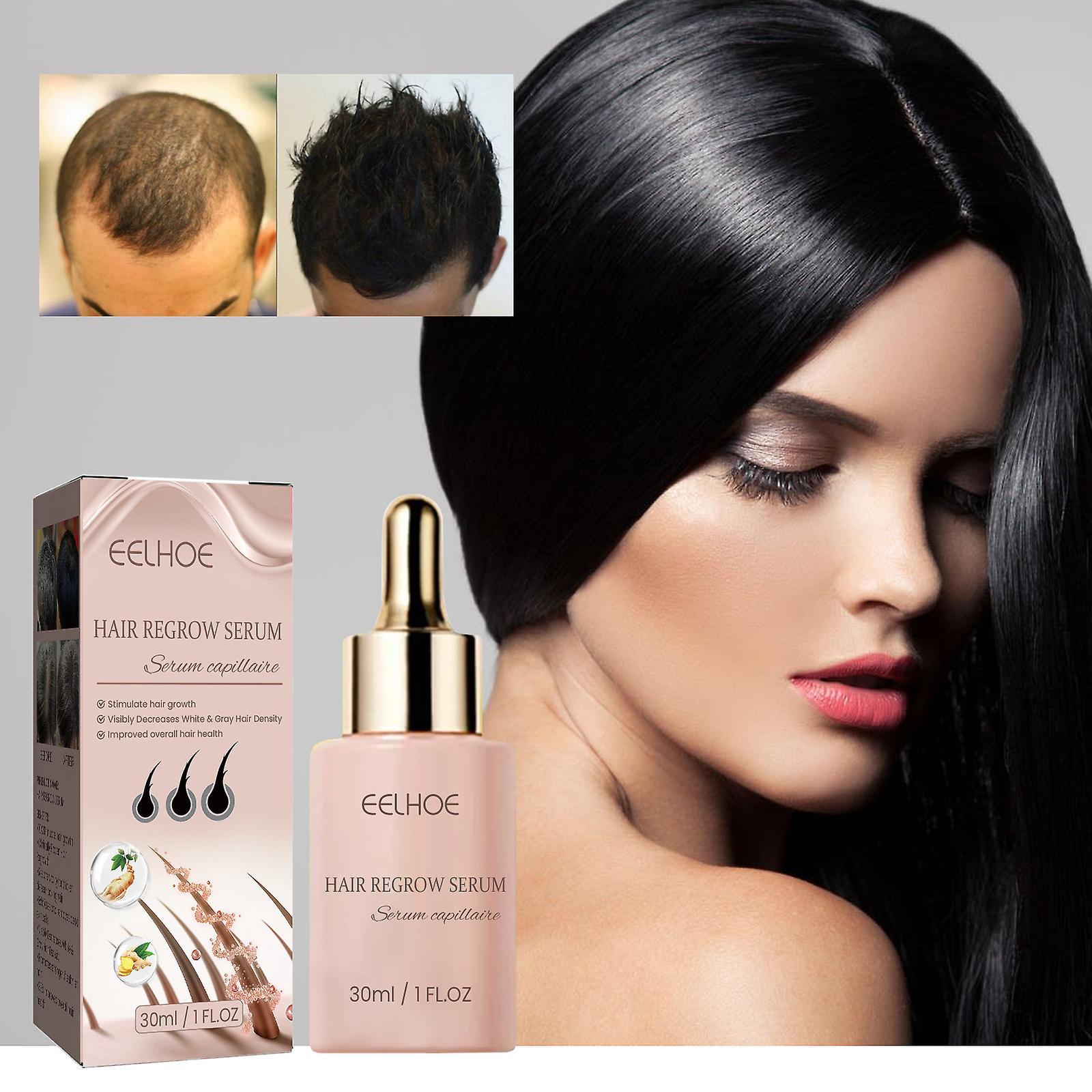 Frusde Hair Growth Serum, Hair Regrow Serum, Advanced Formula for Fuller, Healthier Hair, Reduces Breakage and Shedding Vegan Hair Growth Serum 1pcs