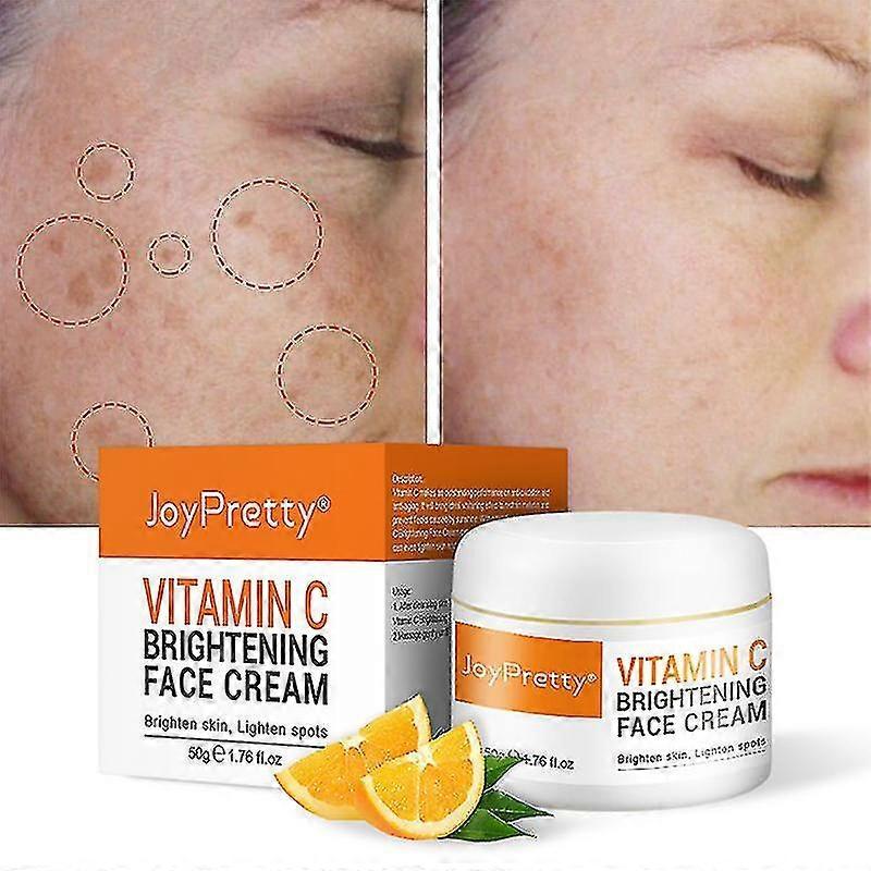 Xtiger Face Cream Vitamin C Cream Remove Dark Spots Whitening Moisturizing Anti-aging