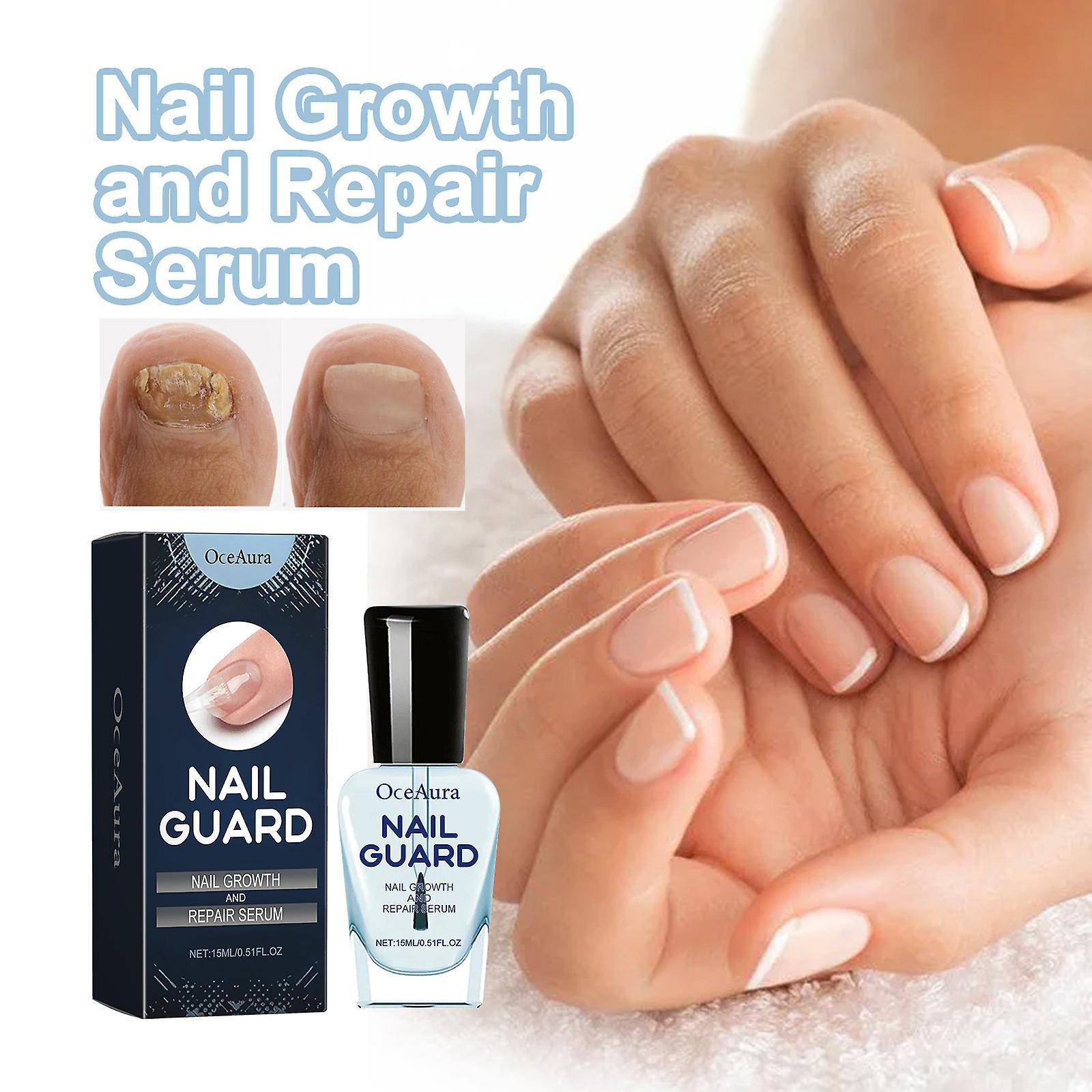 Nspiel Nail Growth And Repair Serum, Nail Cuticle Oil Nail Care Strengthener Treatment Serum Helps Repair Brittle & Damaged Nails 1pcs - 15ml