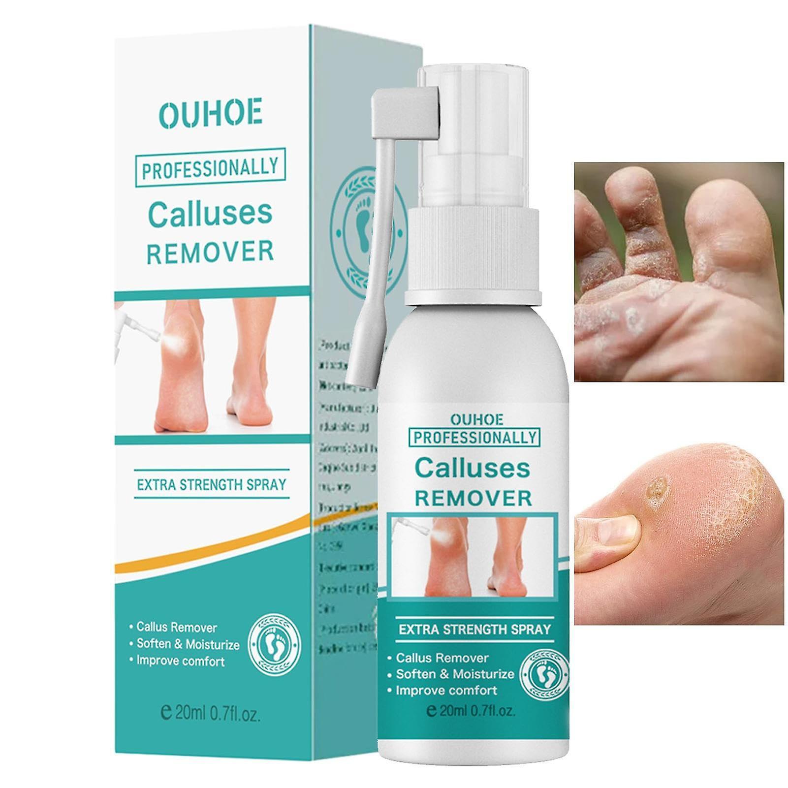 Langray Instant Foot Peeling Spray - Foot Peeling Spray for Remove Dead Skin - 20ml Remove Dead Skin, Dry Toe Skin & Calluses Quickly