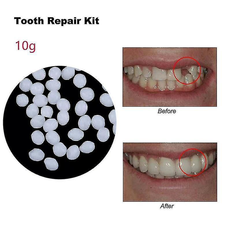 SML 30-50g Tooth Repair Glue Resin Resin Denture Adhesive Temporary False Teeth 10g