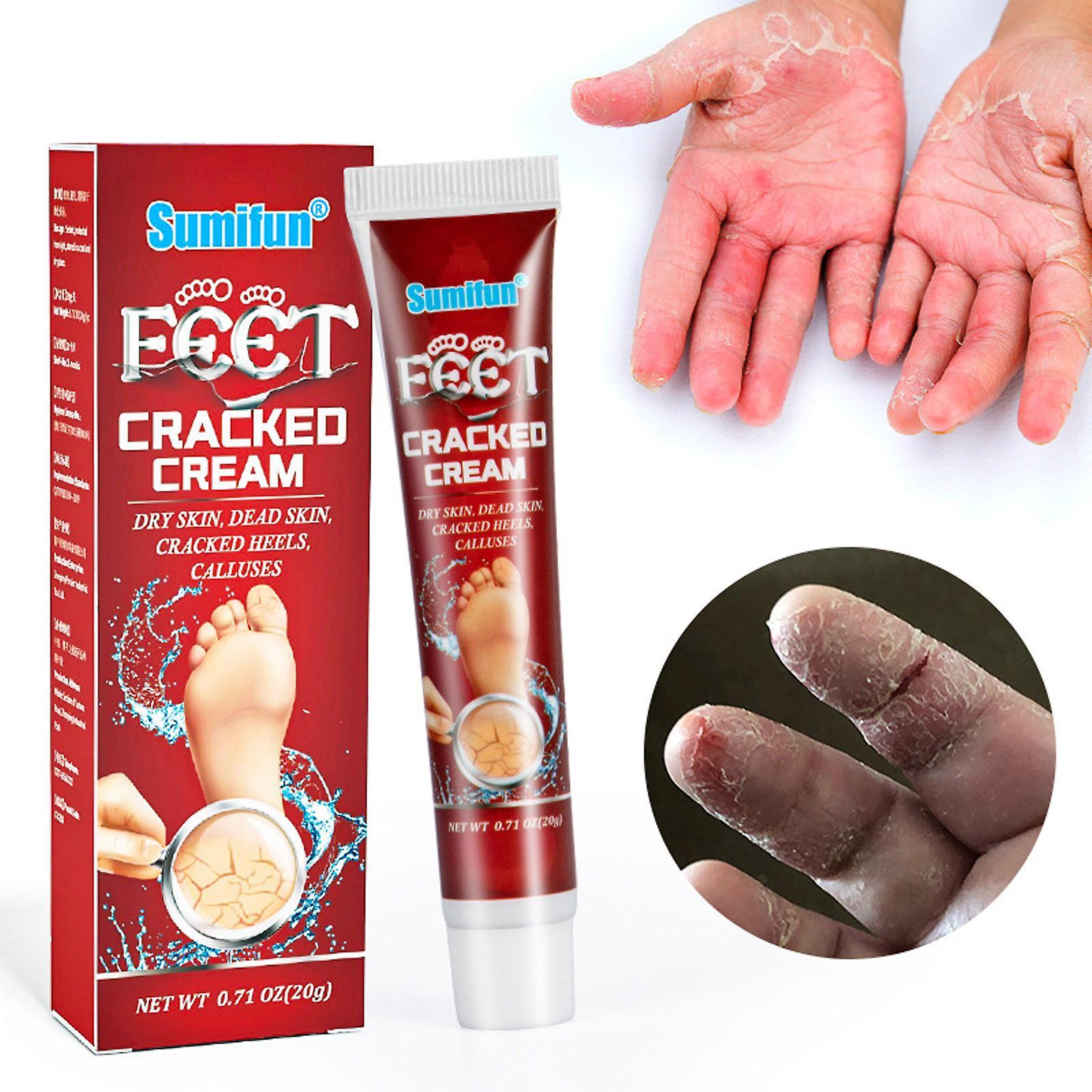 Kakanwo Hand And Foot Chapped Cream Dry Cracking Anti- Cracking Cream Multicolor One Size