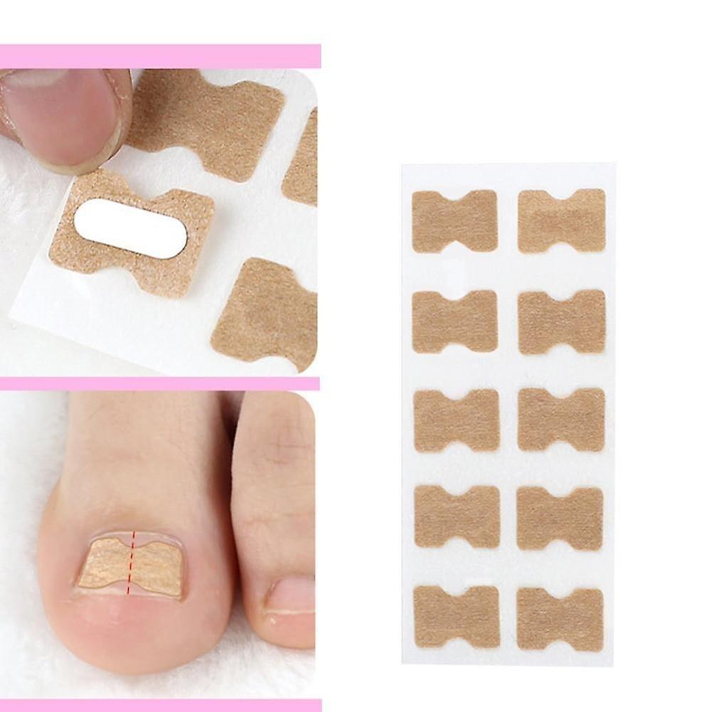 Slowmoose Ingrown Toenail Corrector Sticker - Paronychia Treatment Fixer,  Recover ,