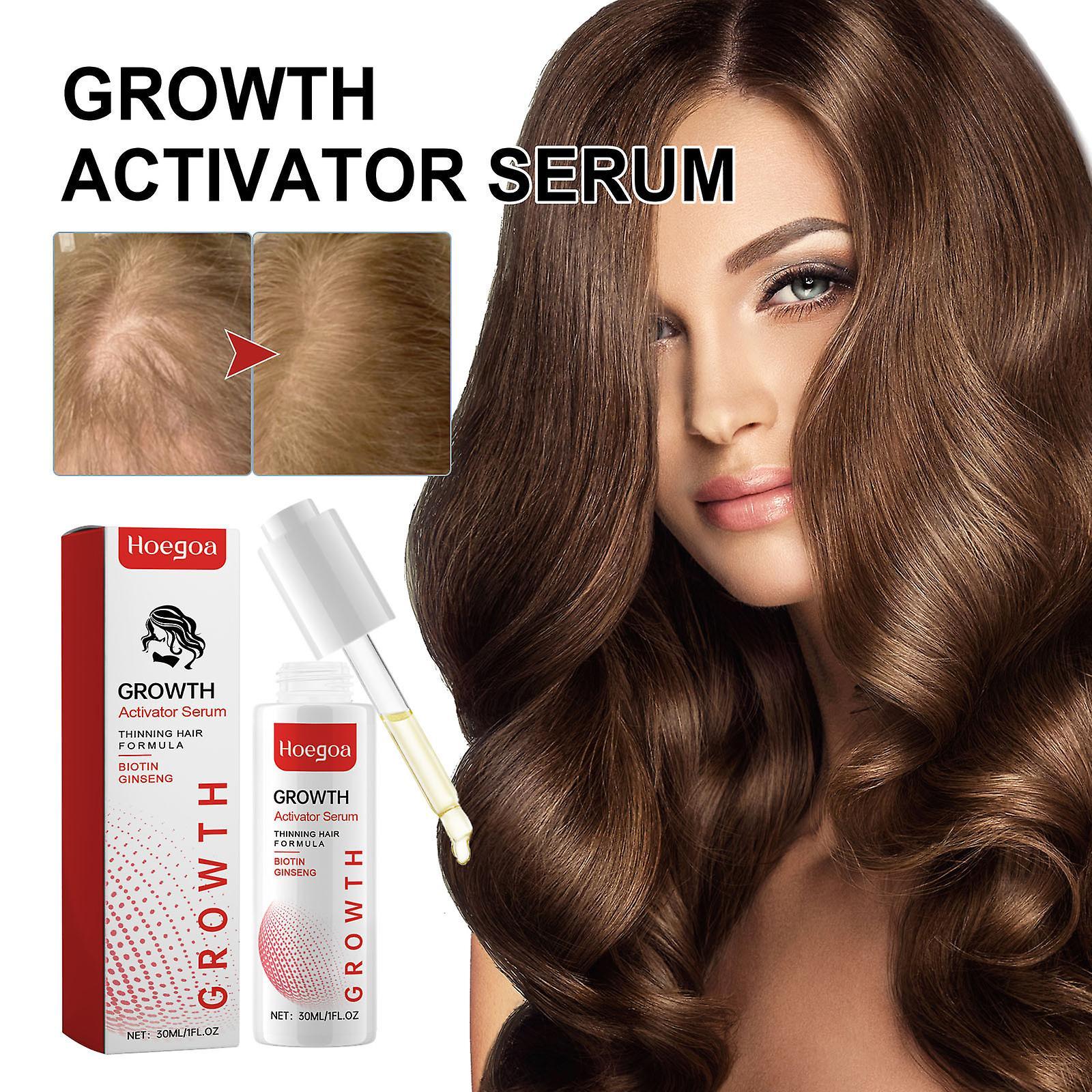 Baodan Scalp Serum Hair Growth Serum For Women Men For Hair Loss Hair Thinning Hydrates Scalp For Thicker Hair 30ml