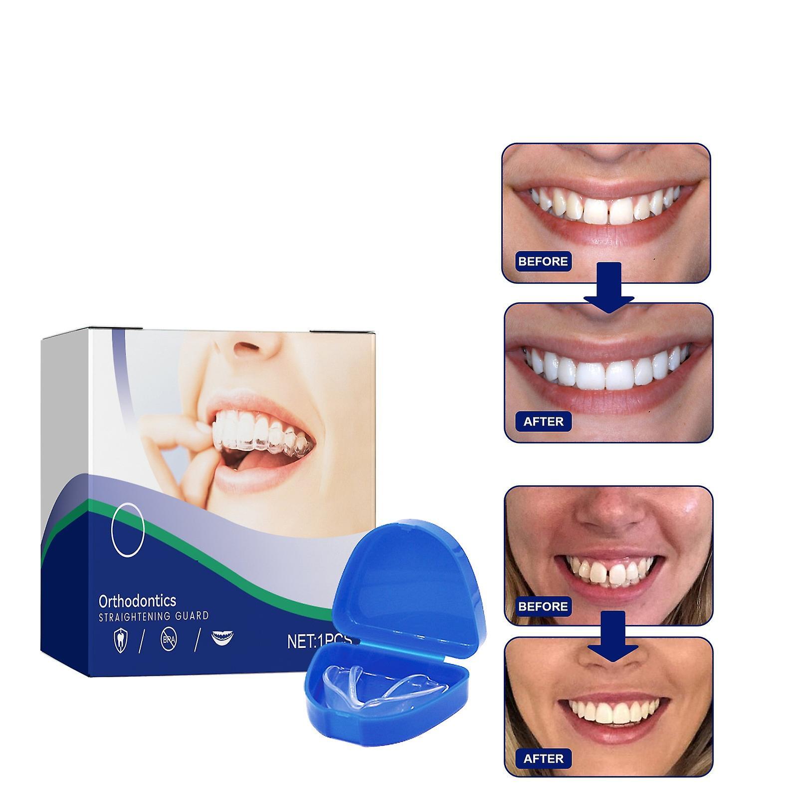 Ofocase Mouth Guard For Clenching Teeth At Night, Moldable Mouth Guard For Teeth Grinding Clenching Bruxism 1 pair