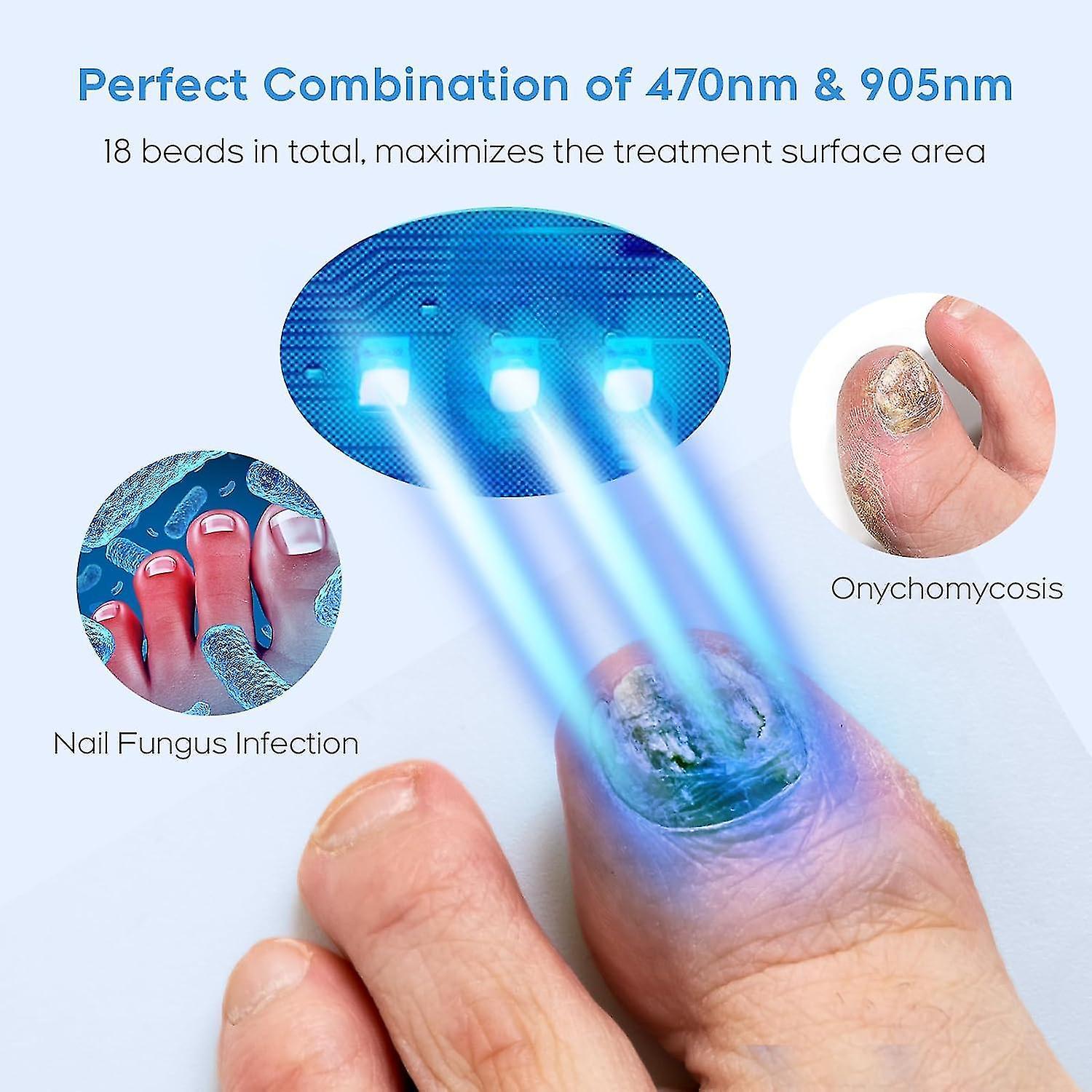 Winov Nail Fungus Cleaning Laser Device for Multiple Toenail, Home Use 905nm Infrared Light + 470nm Blue Light Nail Fungus Laser Treatment Device