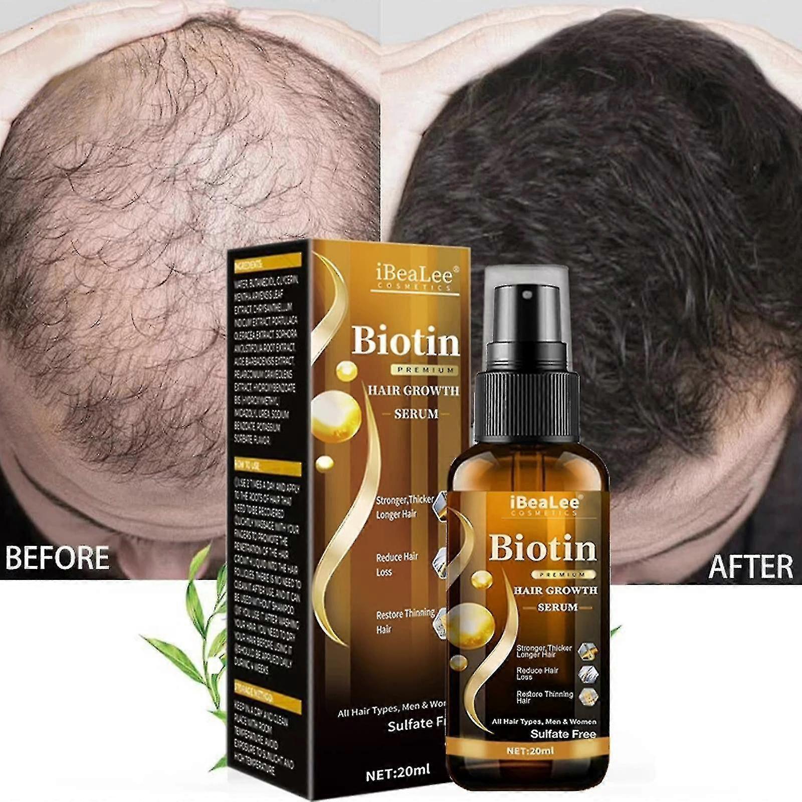 Skwtlv Hair Growth Products Biotin Fast Growing Hair Care Essential Oils Anti Hair Loss Spray Scalp Treatment For Men Women 1Pcs