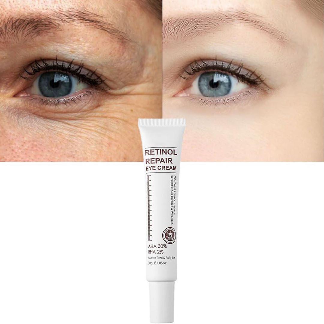 Hoh Retinol Repair Eye Cream, Retinol Eye Cream For Dark Circles Puffiness And Bags Under Eyes, Instant Results Firm Eye Tightener Retinol Eye Crea...