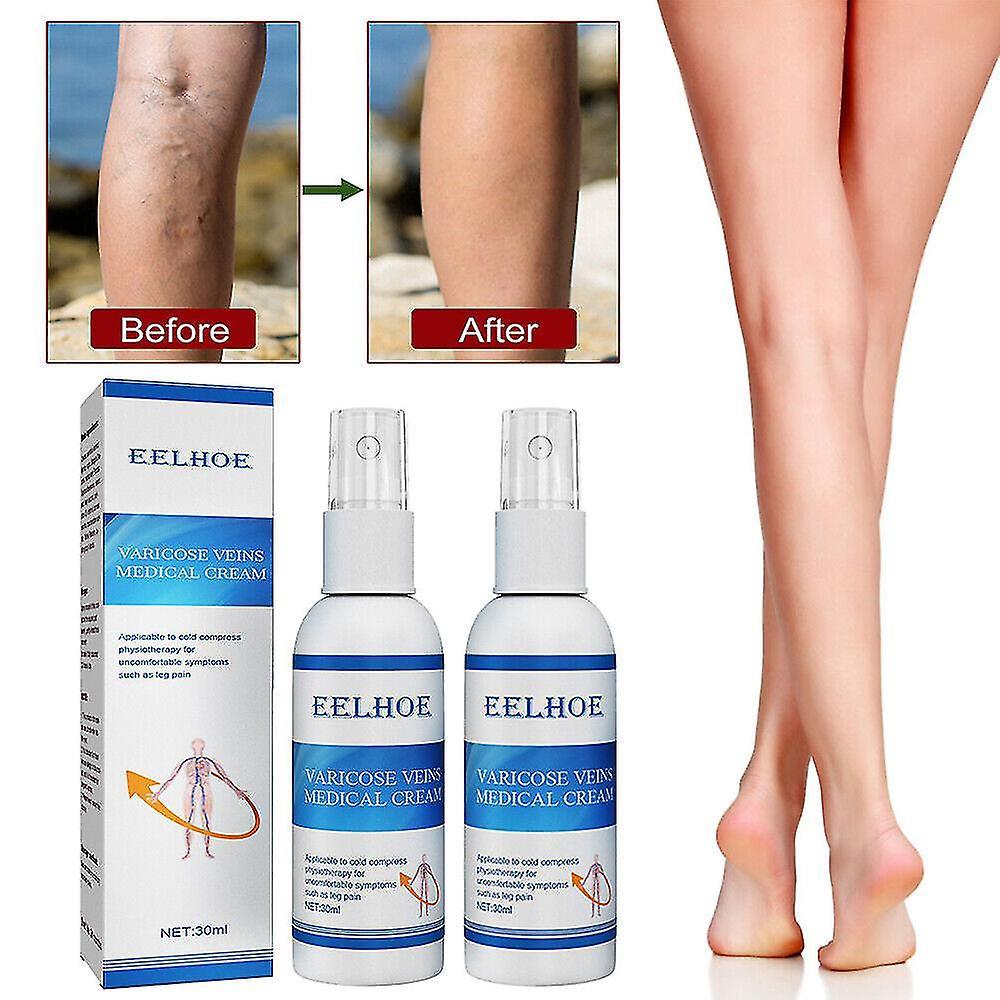 Aimei Veinfix Varicose Treatment Spray Veinhealing Varicose Veins Treatment Spray Intravenous Massage Spray