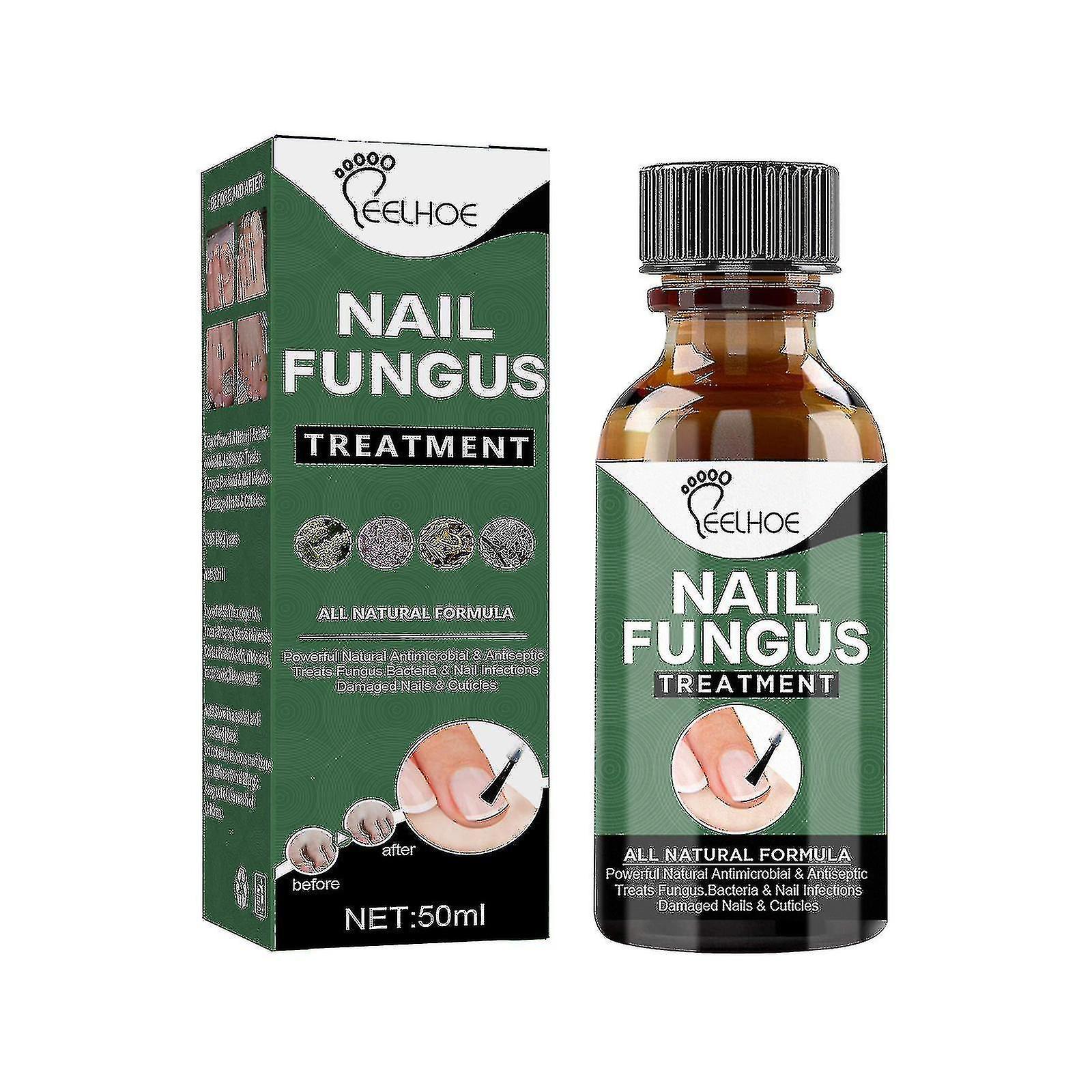 Unbrand Extra Strong Nail Fungus Treatment, Best Nail Repair Stop Fungal Growth Effectiv