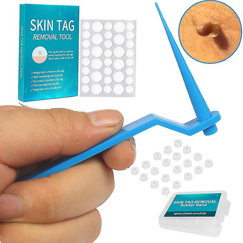 Serh Skin Tag Removal Kit Safe & Painless Stem Warts & Mole Removal Kit For All Sizes Skin Tag(blue)