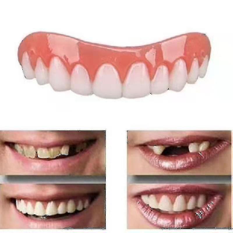 Upper And Lower Dentures 2 Sets Of Dentures, Upper And Lower Jaw Dentures, Natural And Comfortable, Protect The Teeth, And Regain A Confident Smile