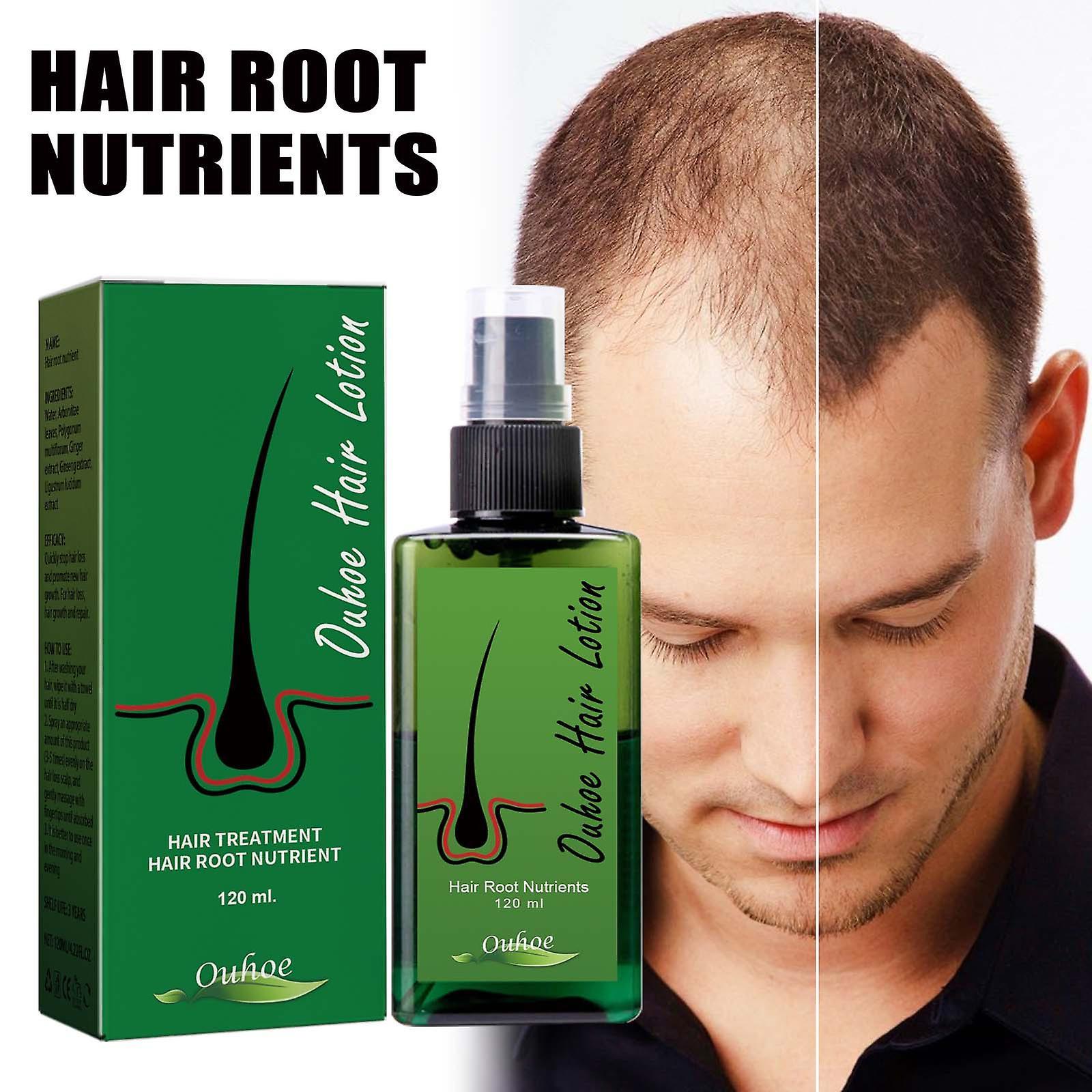 Kakanwo Hair Growth Spray, 120Ml Regenerating Nourishing Mist, Hair Growth Essence Hair Lotion for Men And Women Green