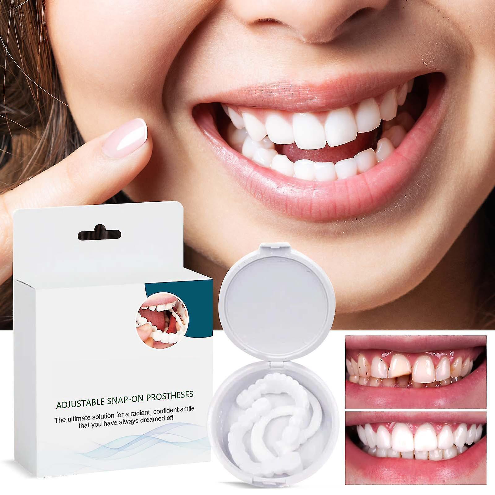 Fongwan Denture Teeth Temporary Fake Teeth For Snap On Instant & Confidence Smile, Dental Veneers For Temporary Teeth Restoration 3Pairs upper and ...