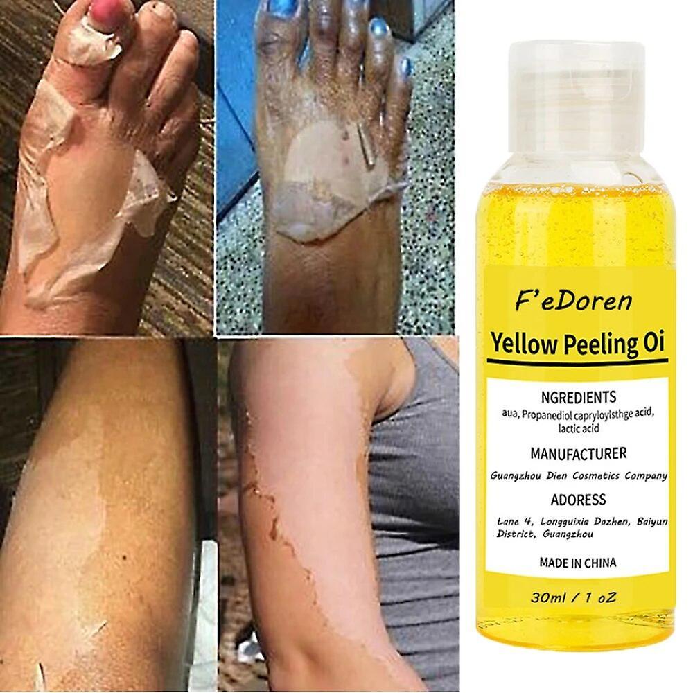 Ninesun Yellow Peeling Oil Bleaching Dark Skin Retinol With Peptide Spots Blackheads Blemishes Bad Skin Spot Treatment Even Skin Tone 30ml