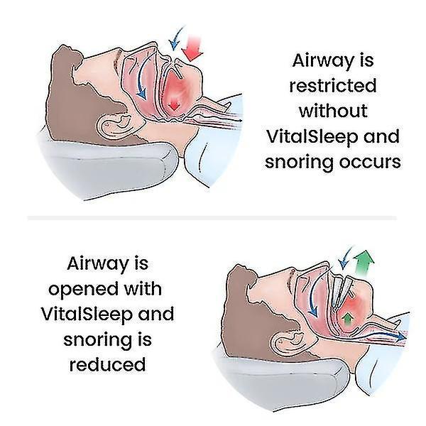 FLARUT Adjustable Mouth With Silicone Anti-snoring Device