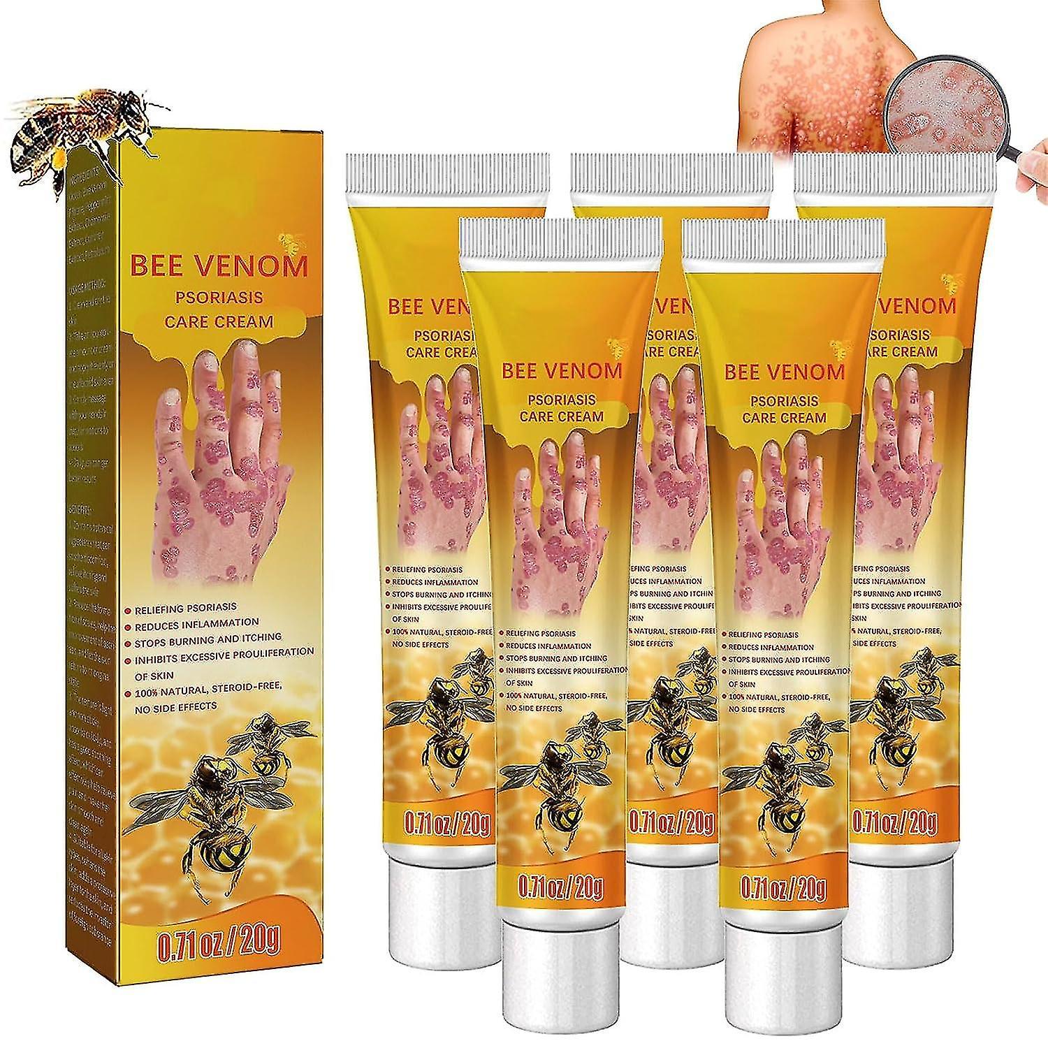 Frusde Bee Venom Psoriasis Treatment Cream, New Zealand Bee Venom Professional Psoriasis Treatment Cream, Soothing And Moisturizing Psoriasis Cream...