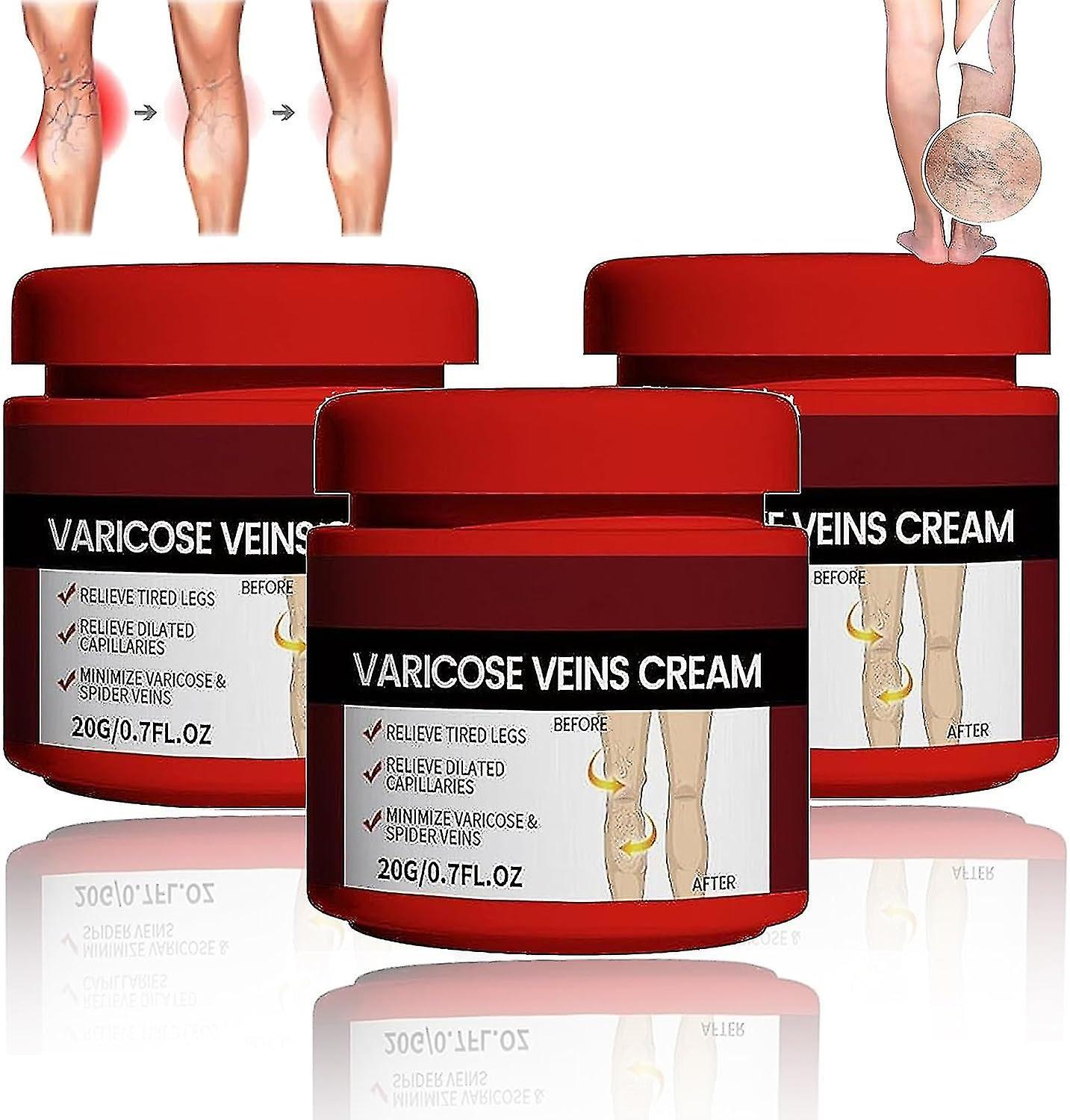 Sunset Cream Varicose Veins, Varicose Veins Treatment For Legs, Varicose Vein & Soothing Leg Cream Strengthen Capillary Health 3pcs