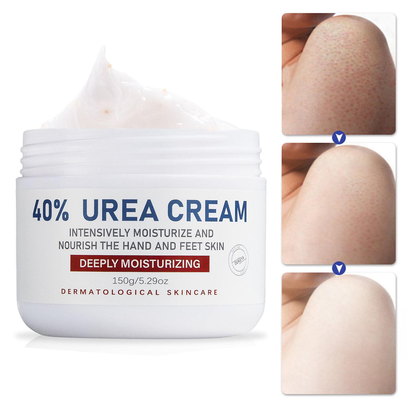 Gaoguang Urea Foot Cream,Urea Cream For Feet, Urea Foot Cream 40 Percent Foot Cream For Cracked Heels And Dry Skin, Deep Moisturising, Callus Remov...