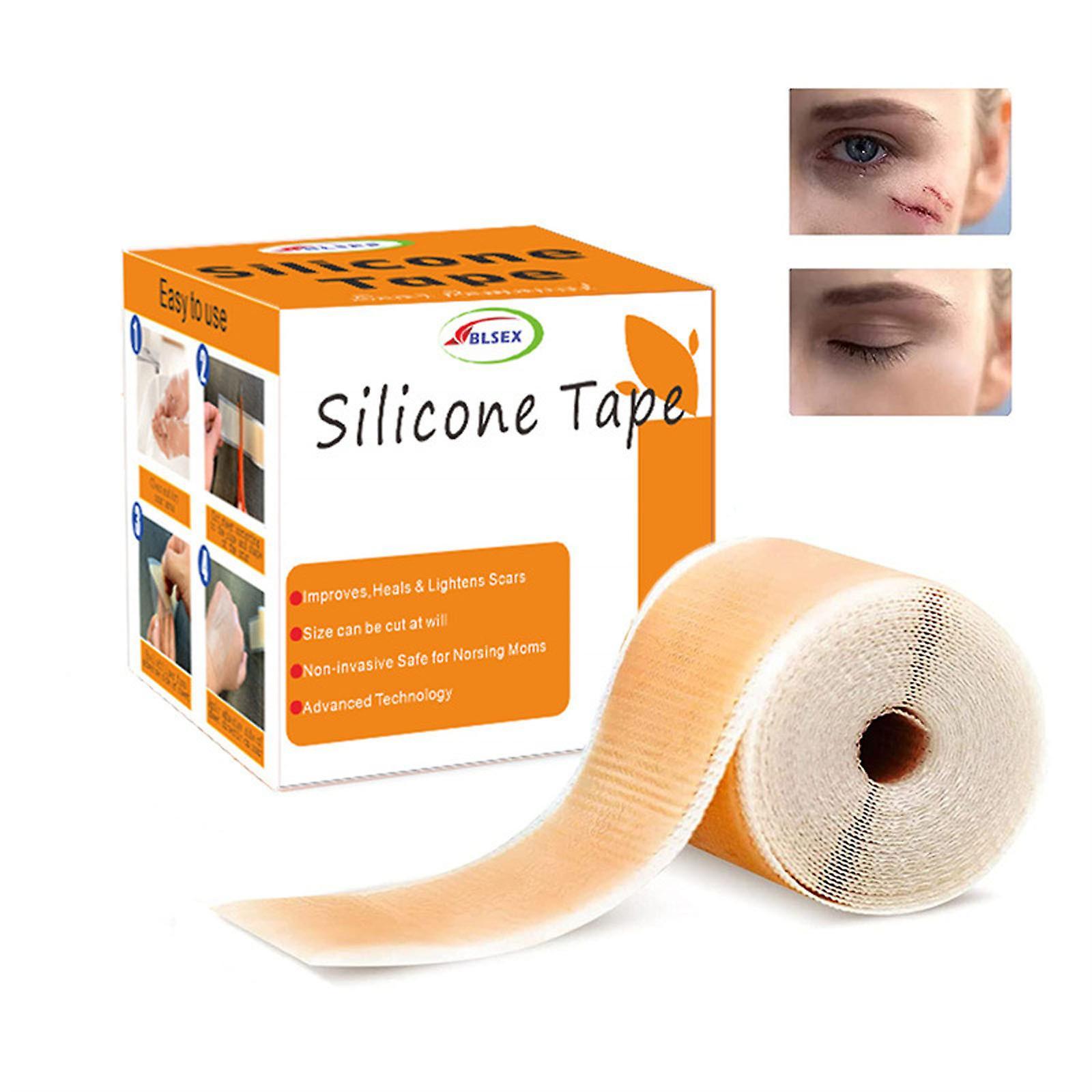 Baodan Silicone Scar Patch, Silicone Scar Tape Roll, Silicone Scar Strip, Reusable Scar Remover For Caesarean Portion, Keloid, Etc. AS SHOWN