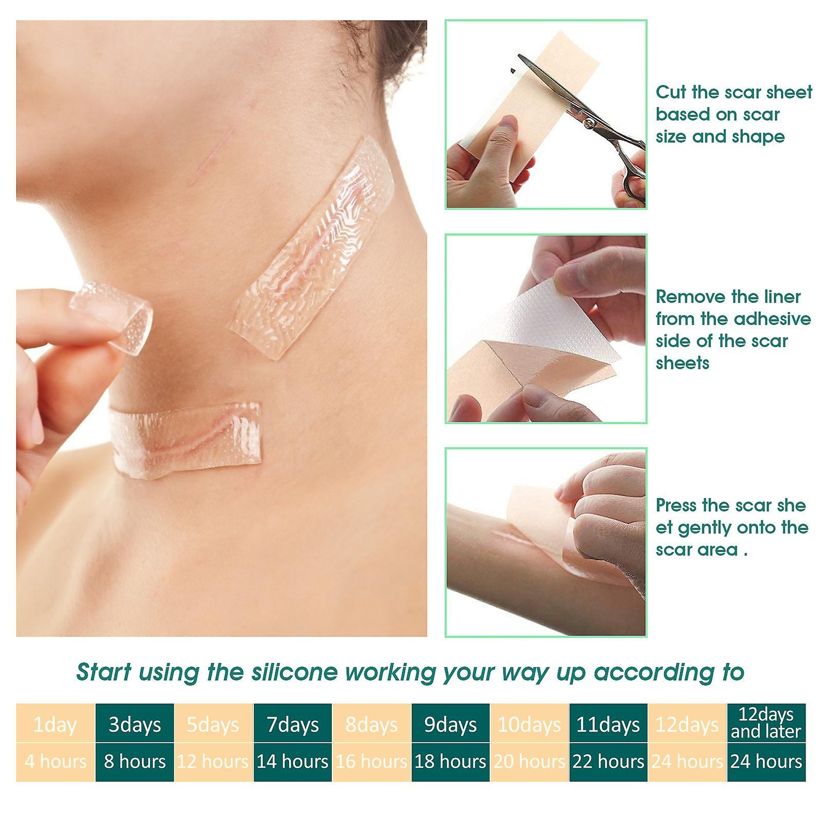 Mjju Clear dressing to help make scars flatter, softer and lighter, adhesive dressing, scar reducer 1PCS