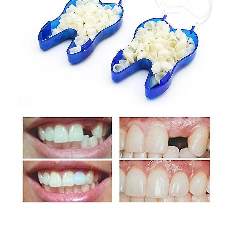 Gunest Temporary Denture Braces Occlude Upper Dentures Veneer Dentures Missing Teeth Broken Teeth