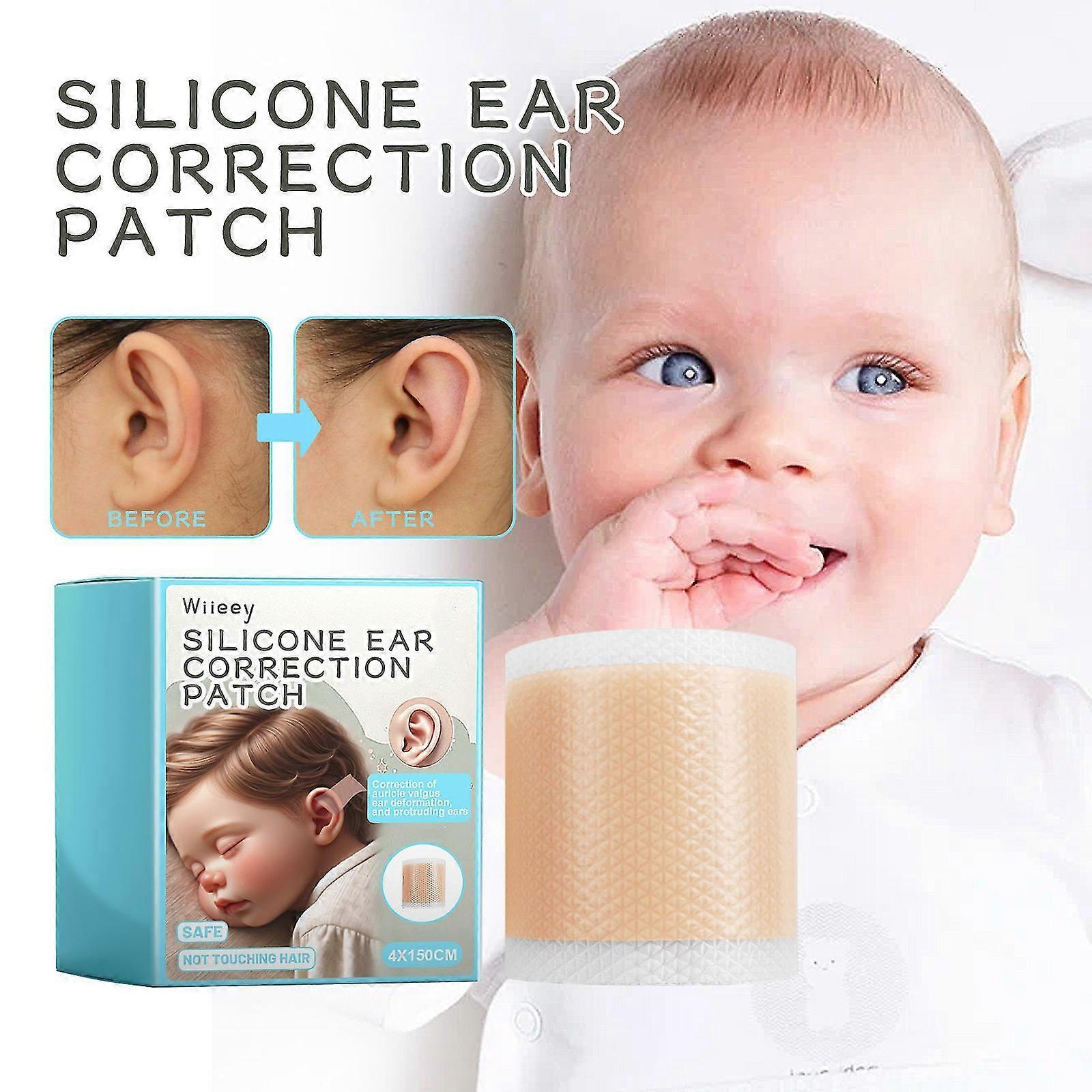 Unbrand Baby Soft Breathable Silicone Ear Correctors Tape, Baby Auricle Valgus Correction Patch For Child Infant Baby Ear Correction 1pcs