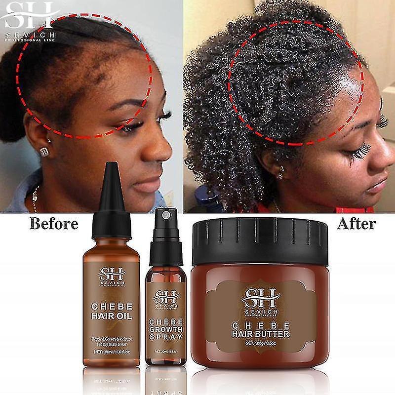 Cloud Xiang African Crazy Hair Growth Product Traction Alopecia Chebe Powder Hair Growth Oil Anti Hair Loss Treatment Spray Hair Care chebe conditi...