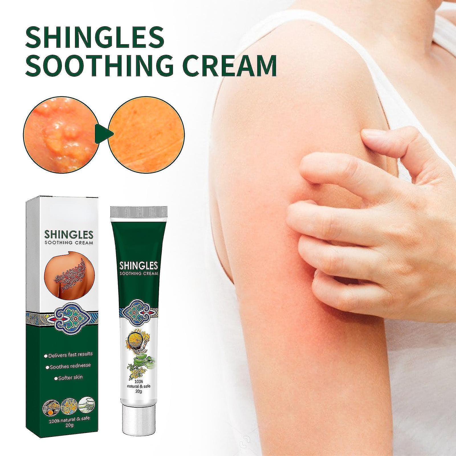 JDSM Shingles Cream, Hand And Foot Cream Skin Cream, Relieve Skin Itching Blisters Care Topical_d261