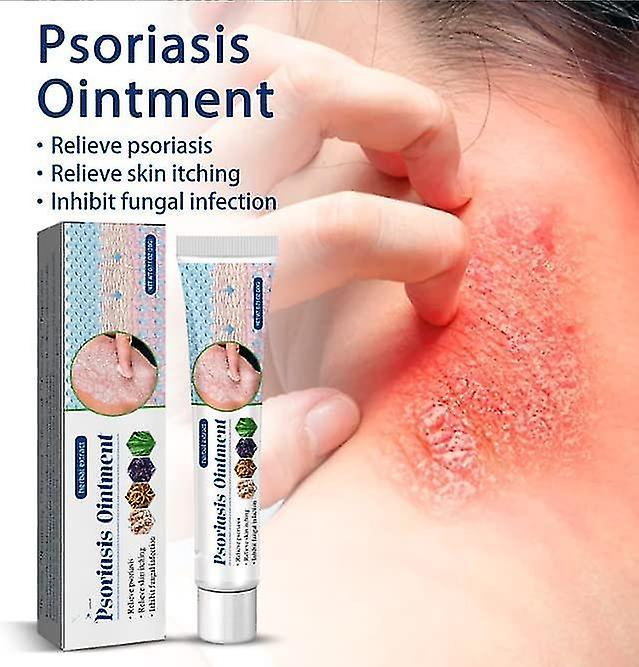 JDSM Psoriasis Cream, Psoriasis Cream Dermatitis Eczema Pruritu Psoriasis Cream_d245