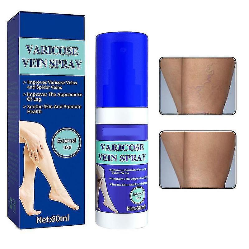 Bod Varicose Veins Spray, Varicose Veins Cream, Varicose Veins Treatment, Varicose Vein Soothing Spray