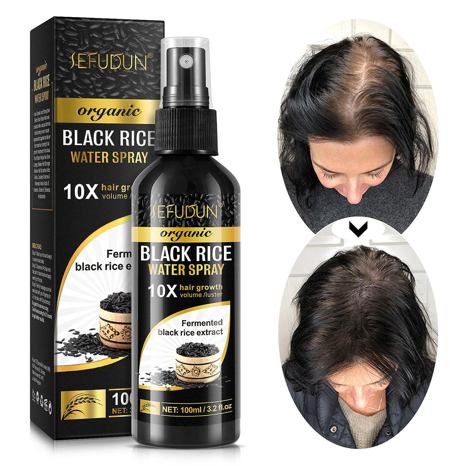 Gaoguang Black Rice Water Hair Growth For Thinning Hair And Hair Loss Hair Growth And Enhancer 100ML A