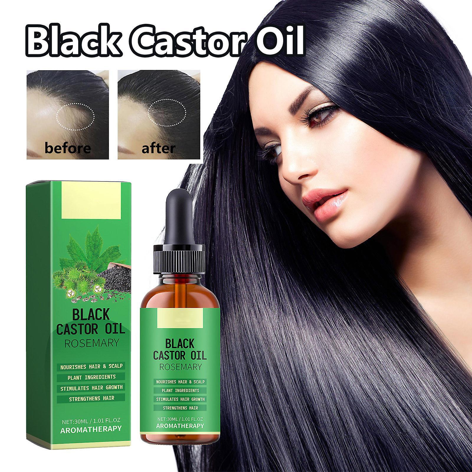 Flye Black Castor Oil Hair Growth Oil With Biotin And Castor Hair Growth Serum For Thicker Longer Healthier Hair Promotes Hair Regrowth Hair Regrow..