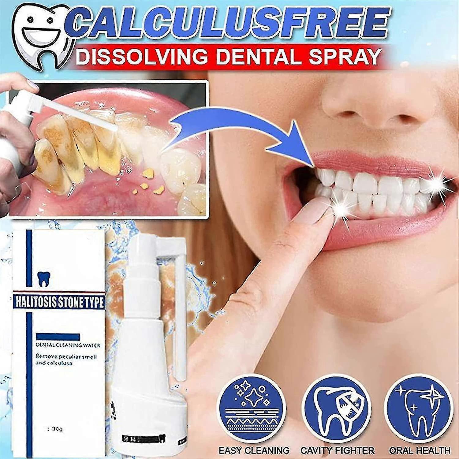 Skwtlv 30ml Calculusfree Dissolving Dental Spray, Dental Calculus Remover Teeth Cleaner