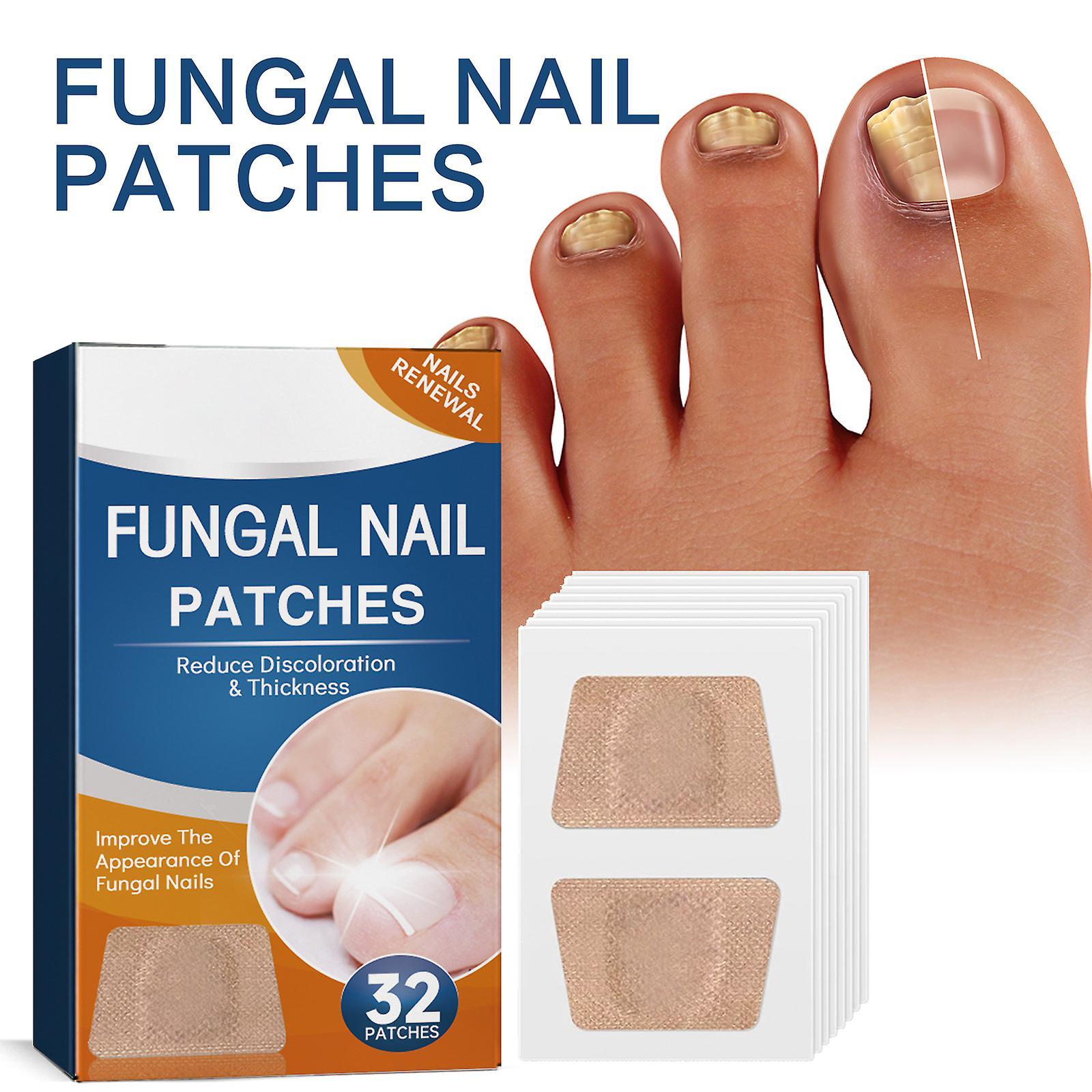 Ofocase Fungal Nail Treatment Patch, Nail Repair Patches Fungal Nail Repair Treatment- Repair Onychomycosis Fungal Nail Patches 2 boxs-64pcs