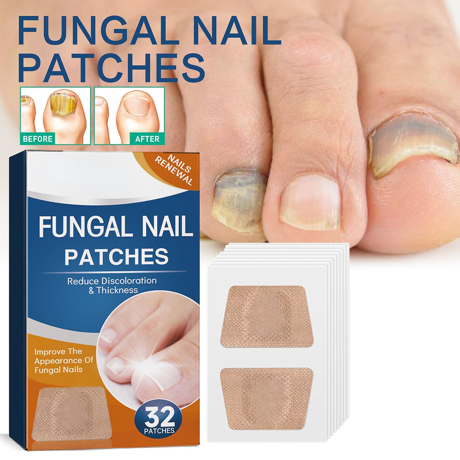 Frusde Fungal Nail Patches, Toenail Fungus Treatment, Nail Repair Patches, Nail Repair Treatment For Damaged Nails And Appearance Of Discolored 2boxes