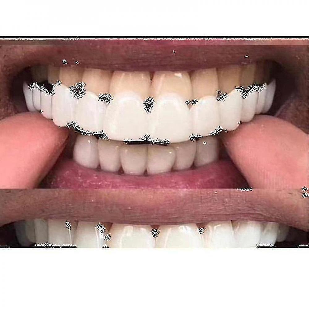 Hgxs New 2024 New Snap On Smile Dental False Teeth Cover Smile Veneers Comfort Fit Flex Denture Teeth VYZ Upper Teeth