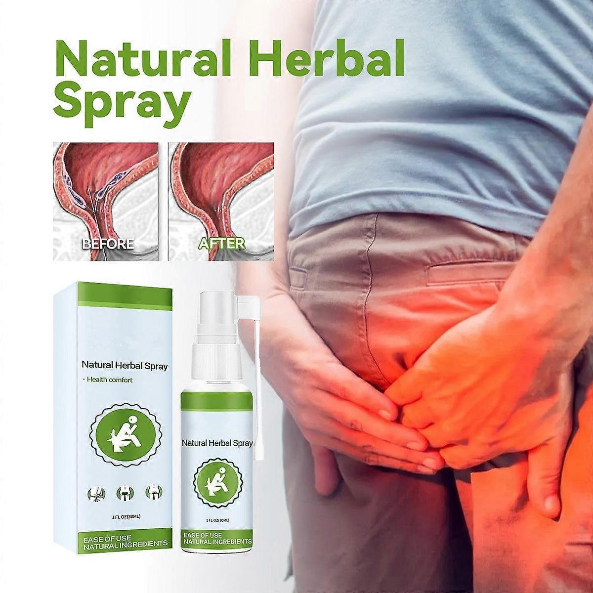 Unbrand Herbal Hemorrhoids Spray, Natural Herbal Hemorrhoids Spray, Hemorrhoids Spray, Hemorrhoids Treatment Spray 1Pcs