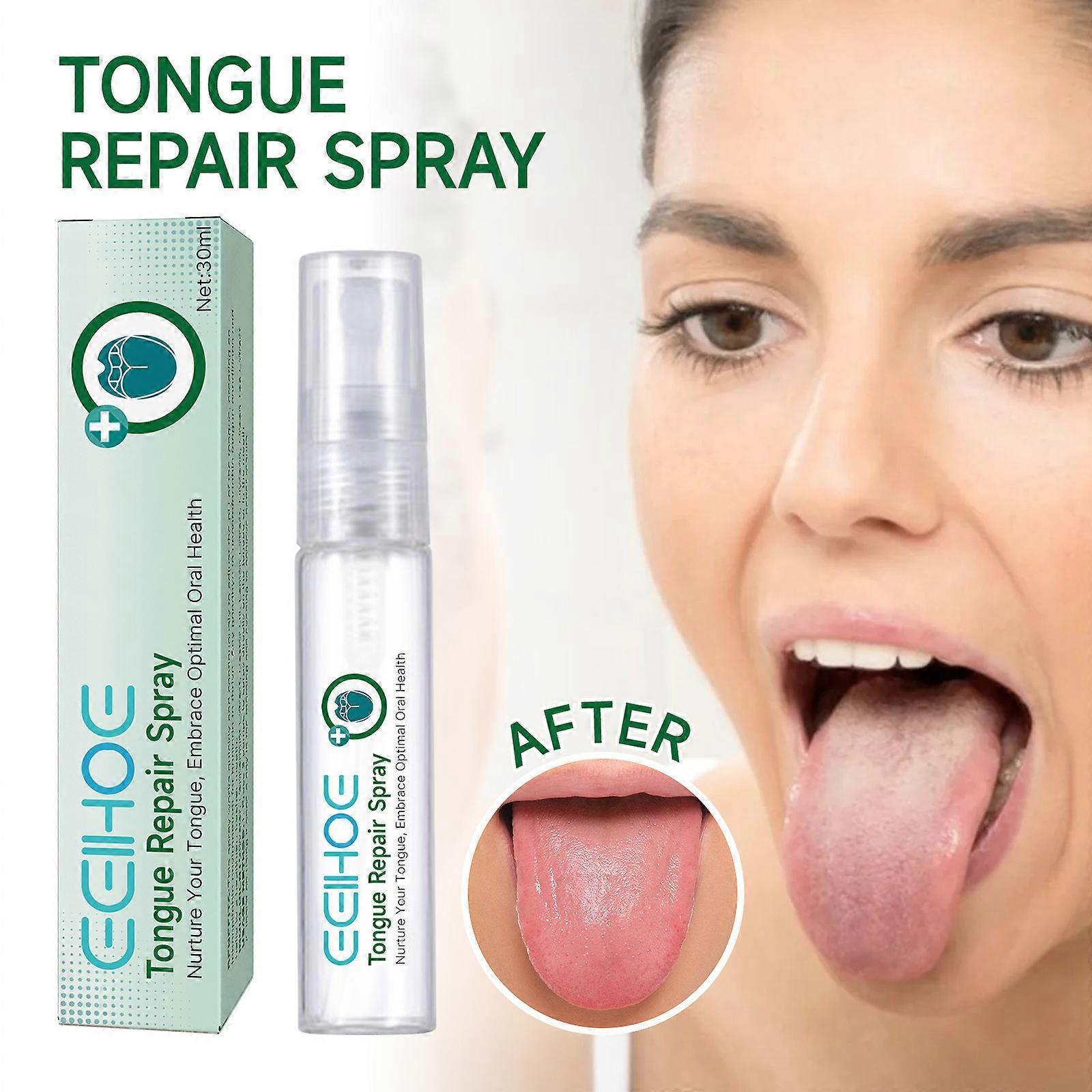 Unbrand Tongue Repair Spray 30ml Reduce Swelling Tongue Relief Treatment Spray for Bad Breath, Tongue Repair Spray for Dryness& Bad Breath 1pcs