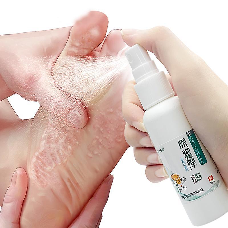 Manchalk Herbal Athlete Foot Anti-fungal Spray Remove Foot Odor Beriberi Itching Foot Care Repair Toe Ulceration Medical Spray Care