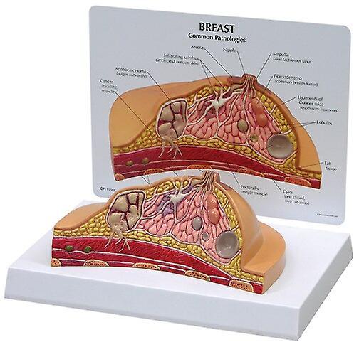 Scale Models Breast disease breast anatomy model human body model anatomical human pathological breast model medical disease & cancer anatomy