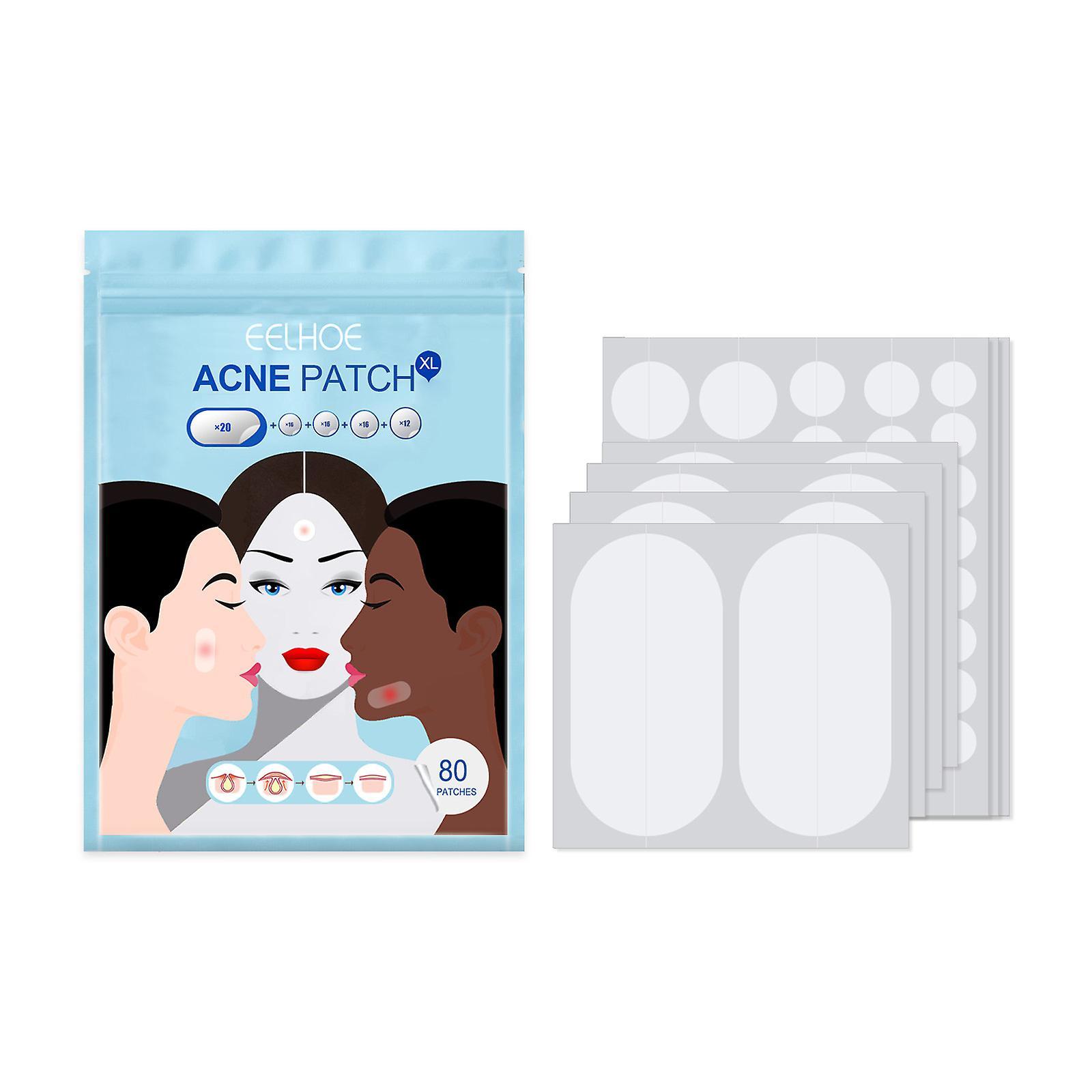 Fruushop Acne Pimple Patches 5 Sizes 80 Patches For Large Breakoutsacne Patches For Face Chin Or Body Acne Treatment With Tree And Calendula Oil Hy...