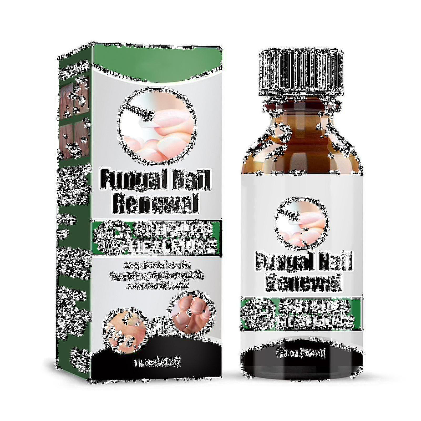 Ceisv Toenail Onychomycosis Treatments Liquid Gental Natural Ingredients Anti-nail Onychomycosis Liquid For Repairing Onychomy