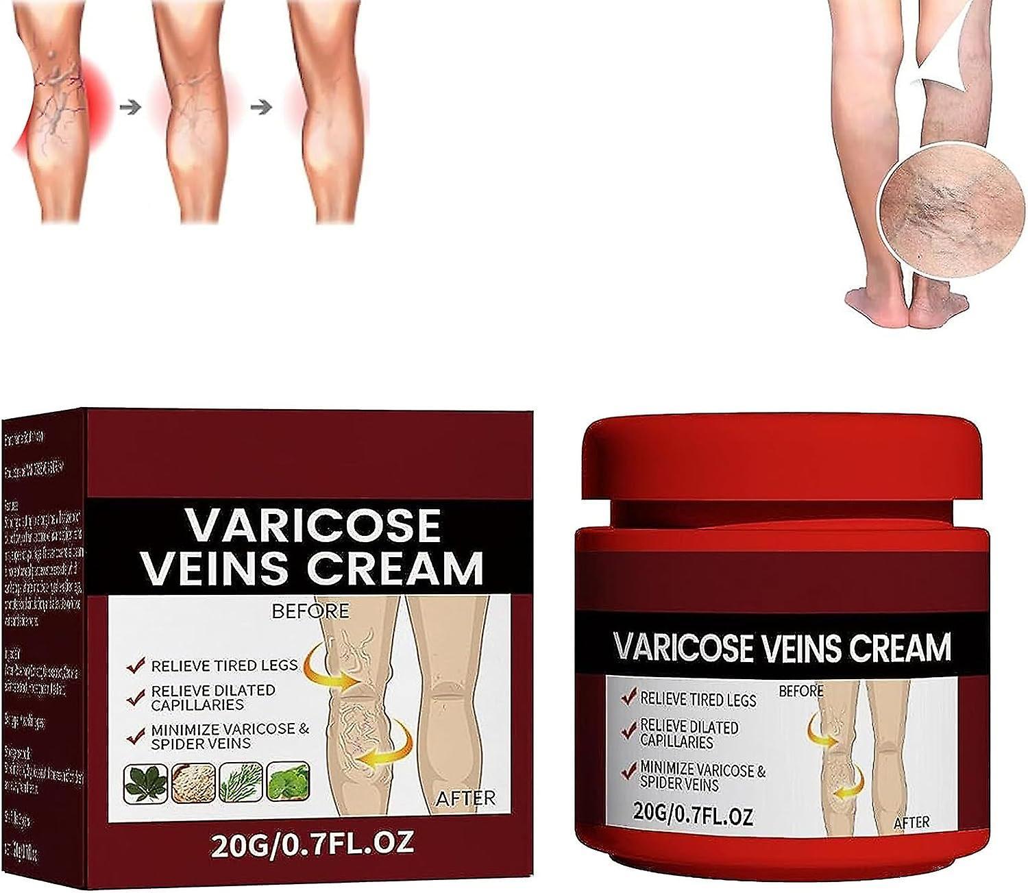 Frusde Cream Varicose Veins, Varicose Veins Treatment For Legs, Varicose Vein & Soothing Leg Cream Strengthen Capillary Health Reduces Spider Veins...