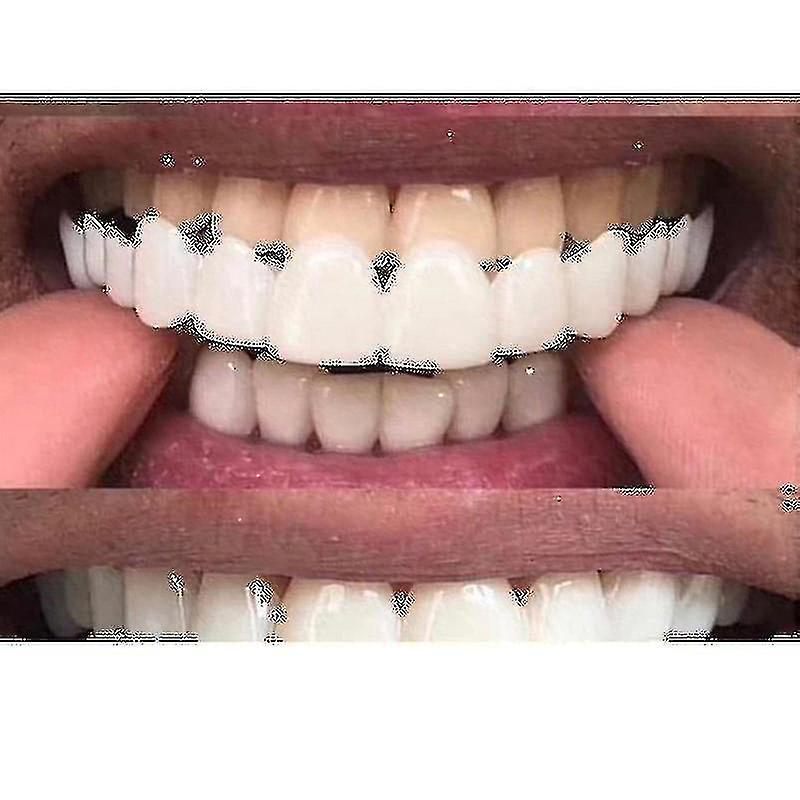 Winov New Snap On Smile Dental False Teeth Cover Smile Veneers Comfort Fit Flex Denture Teeth - Niubi_l25 Upper Teeth