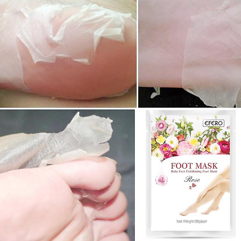 Slowmoose Pedicure Peeling Dead Skin Remover Mask Peel Baby Foot Rose Exfoliant Foot Peel