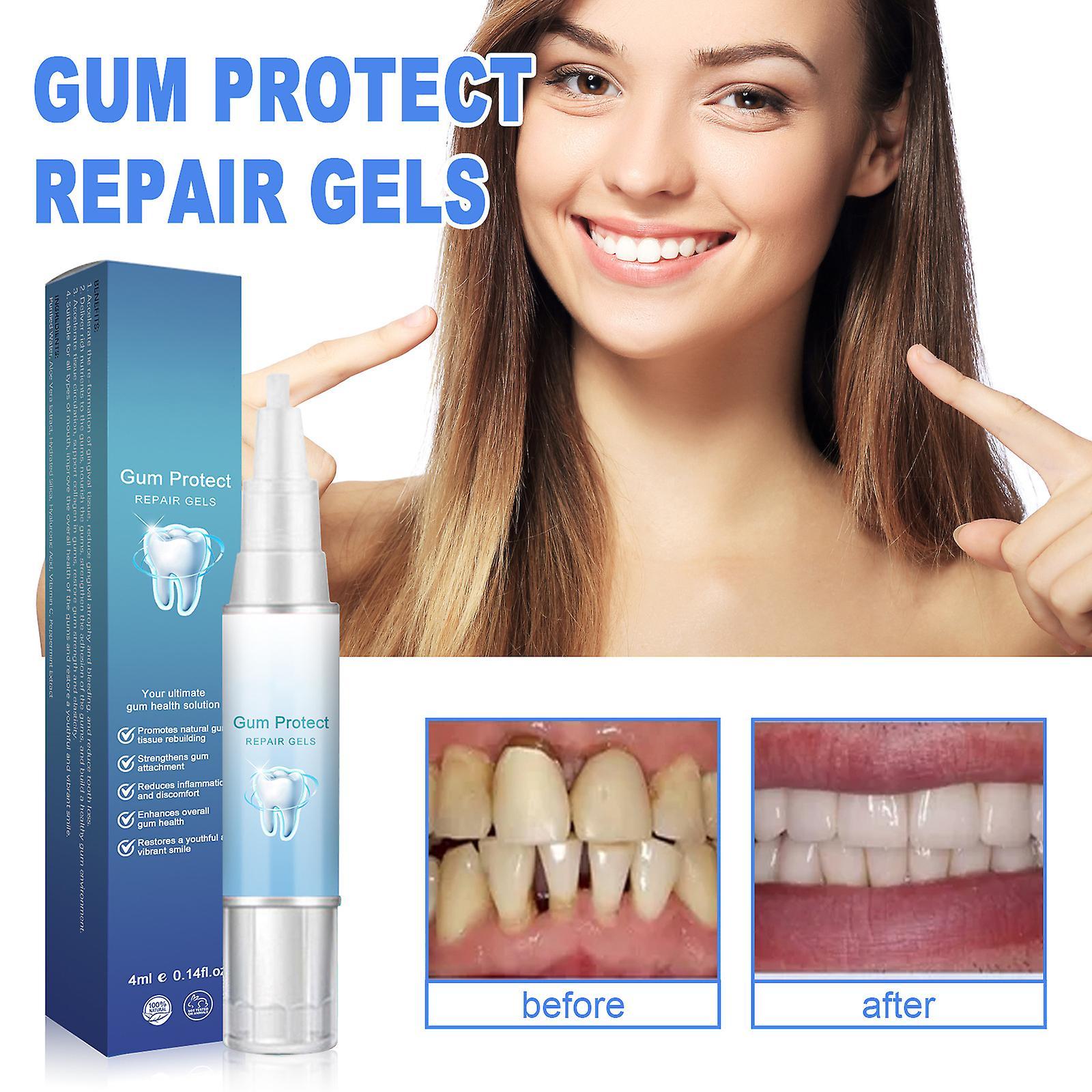 Nspiel Gum Therapy Gel, Gum Regrowth Gel Teeth Whitening Essence Pen, Intensive Stain Removal Oral Care Gum Restore Mouthwash 6pcs - 24ml